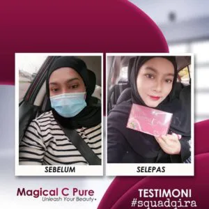 Kebaikan Feedback Magical C Pure Manfaat Vitamin C Sebenar Kosmetik Cida